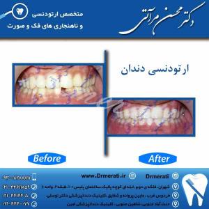 دکتر محسن مرآتی - متخصص ارتودنسی 